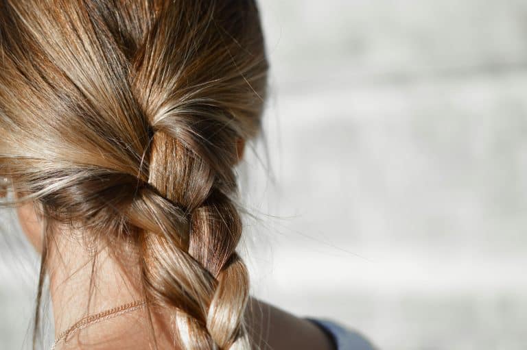 PCOS hair loss